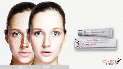 TriLuma hydroquinone + tretinoin Cream for Dark Spots on Face  – Age Spot, Sun Spot, and Melasma